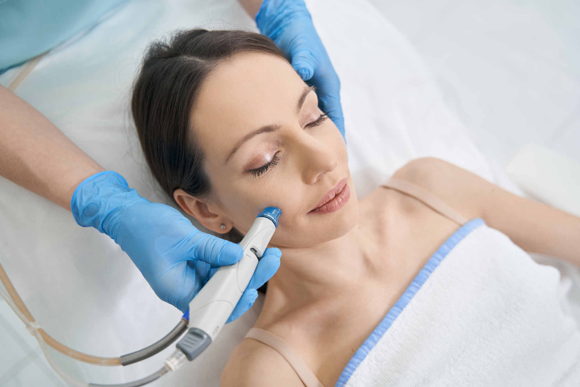 Benefits of HydraFacials