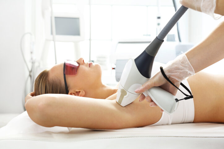 Laser hair removal