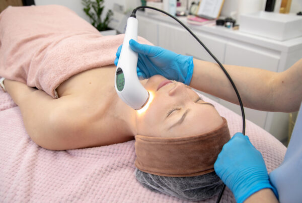 Laser Facial Treatment