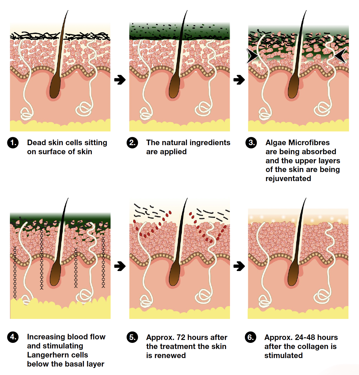 Algae Peel